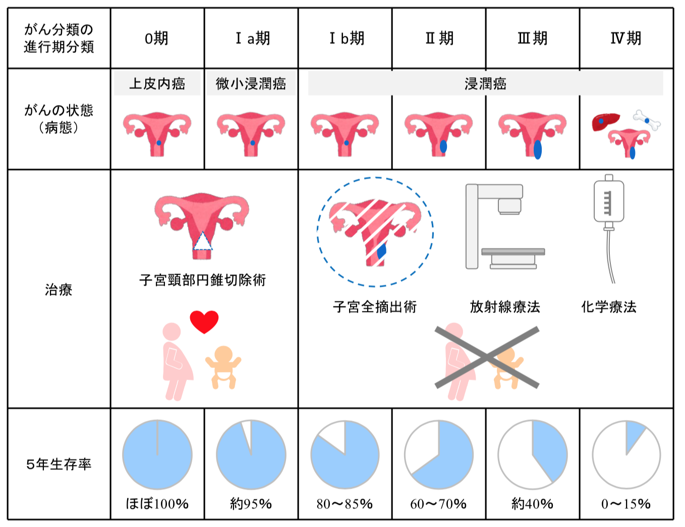 子宮頸がん臨床期分類