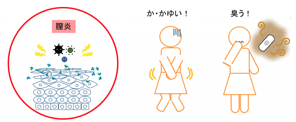 膣内フローラが乱れると、かゆみやにおい、おりものが症状として現れます