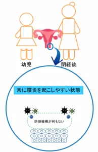 幼児や閉経した女性の膣は膣炎を起こしやすい