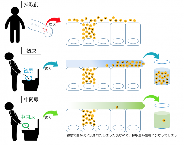 男のクラミジアチェック | アイ・ラボ オンラインショップ